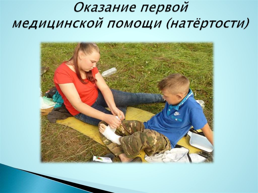 Оказание первой медицинской помощи (натёртости)