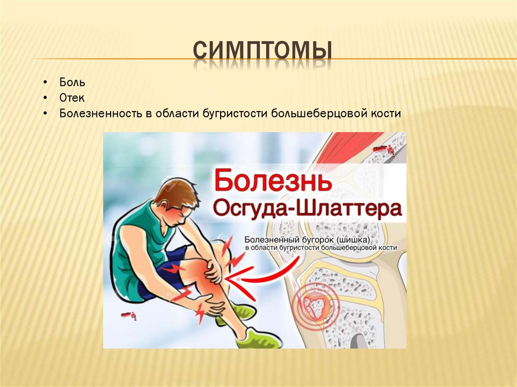 Болезнь Осгуда - Шляттера - презентация онлайн