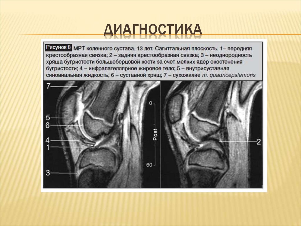 Болезнь шляттера у детей фото