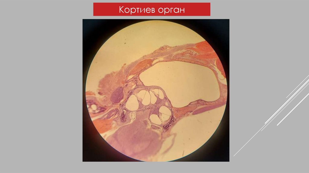 Кортиев орган гистология