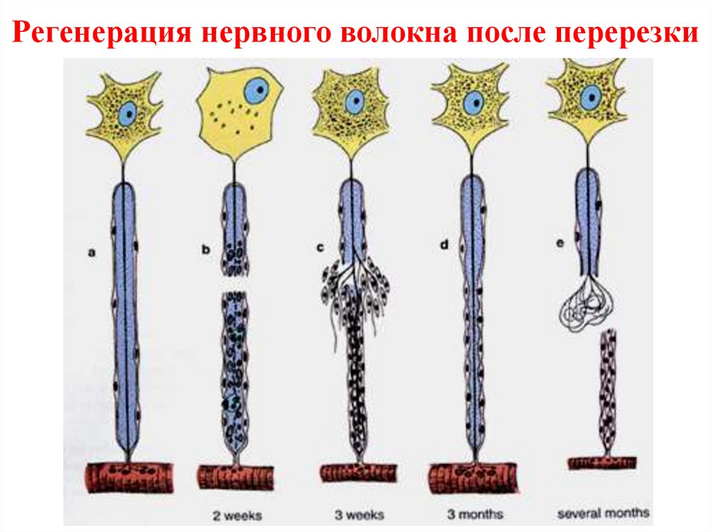 Регенерация нервной ткани презентация