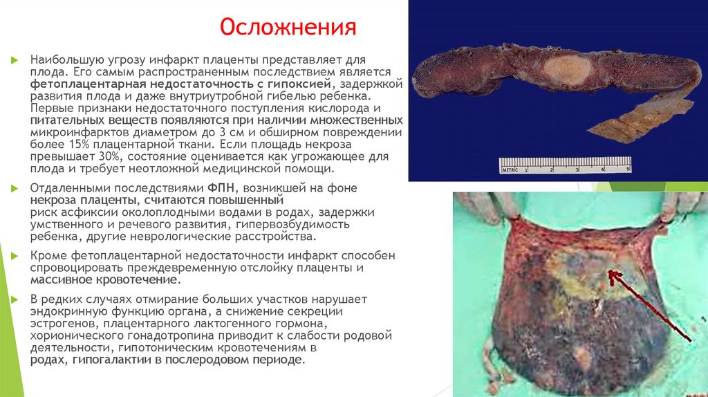 Осложнения