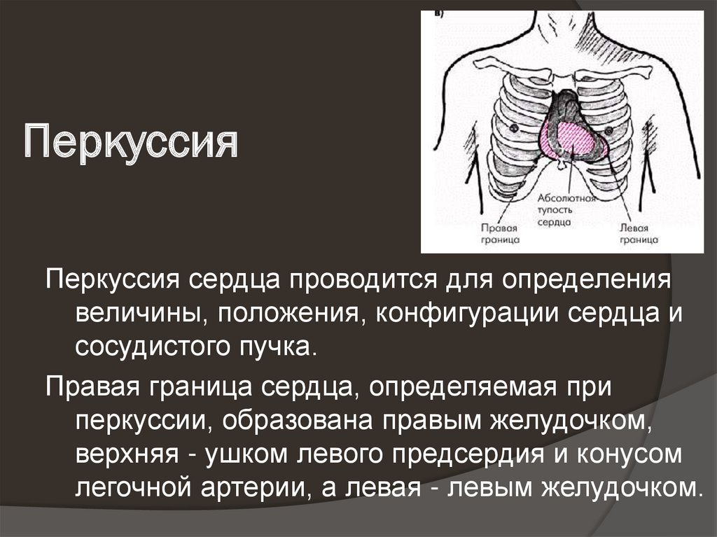 Перкуссия сердца презентация