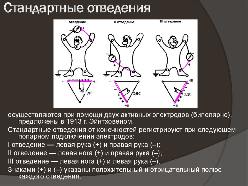 Левые отведения