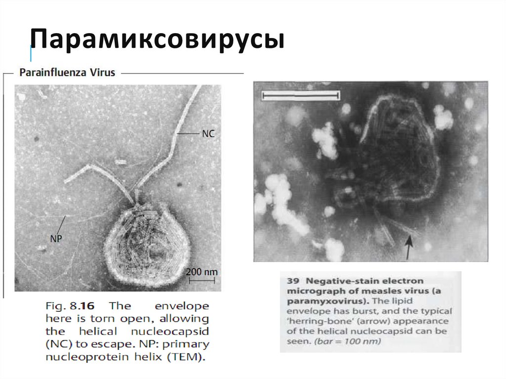 «Респираторные» парамиксовирусы. Респираторные вирусы английский. Paramyxovirus at vebasi. Respiratory virus