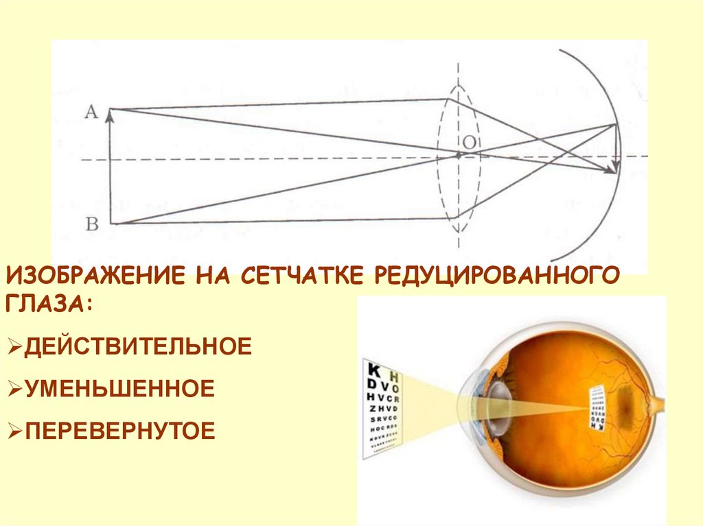 Каким получается изображение на сетчатке глаза. Построение изображения на сетчатке. Изображение предмета на сетчатке глаза. Построение изображения на сетчатке глаза. Какое изображение на сетчатке глаза.