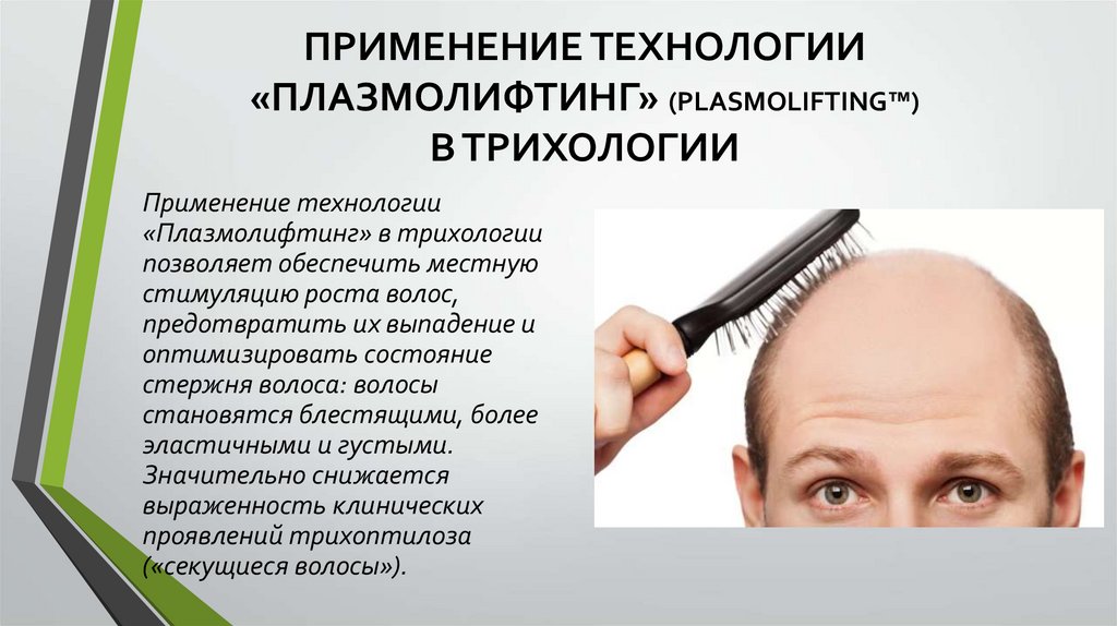 Как подготовиться к плазмолифтингу волос