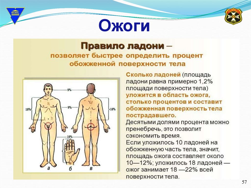 Правила определение ожогов