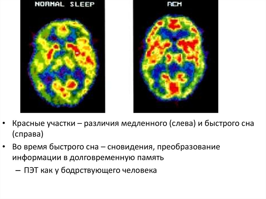 Время активного мозга. Деятельность мозга во сне. Фазы активности мозга. Активность мозга во время сна. Фазы сна и активность мозга.