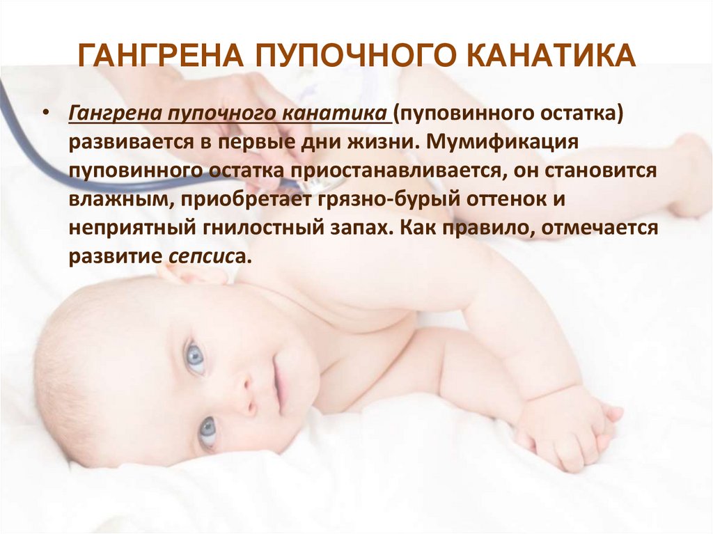 Омфалит мкб 10. Flegmanozniy omfalit. Обработка пупочной ранки новорожденного. Флегмонозный омфалит у новорожденных. Катаральный омфалит у новорожденных.