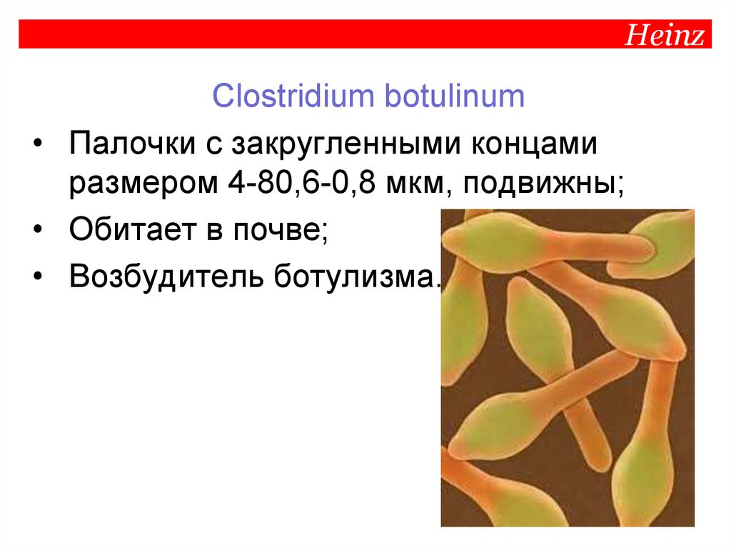 Сульфитредуцирующие клостридии (Clostridia) - презентация онлайн