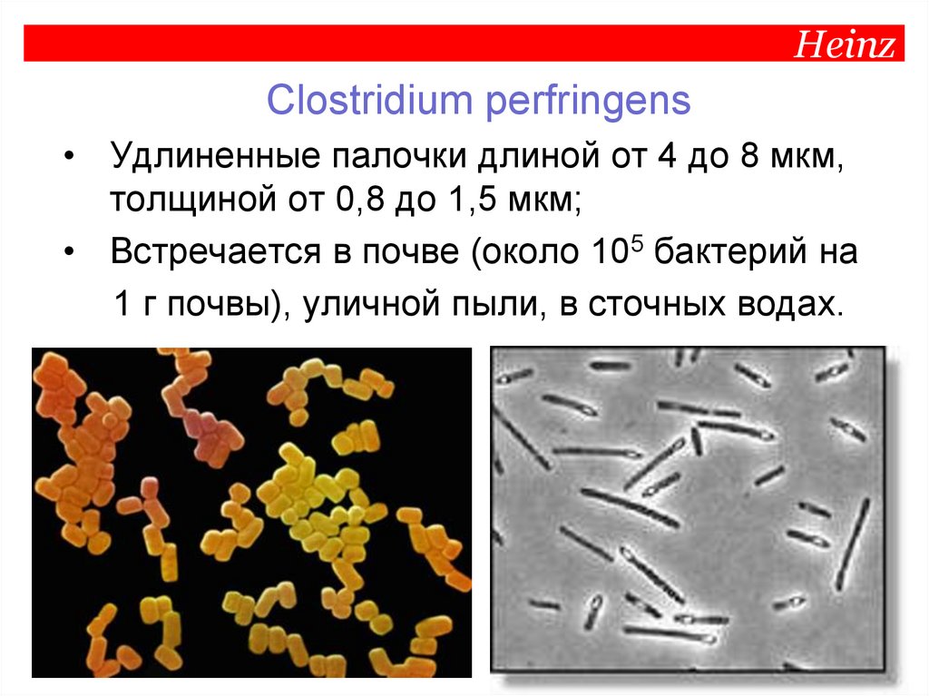 Clostridium spp