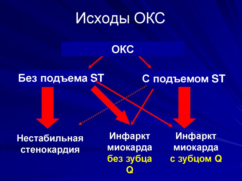 Формы острого коронарного синдрома