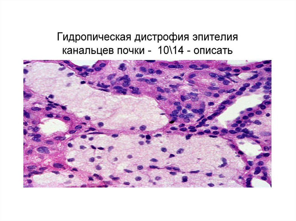 Подпишите виды дистрофий рисунки