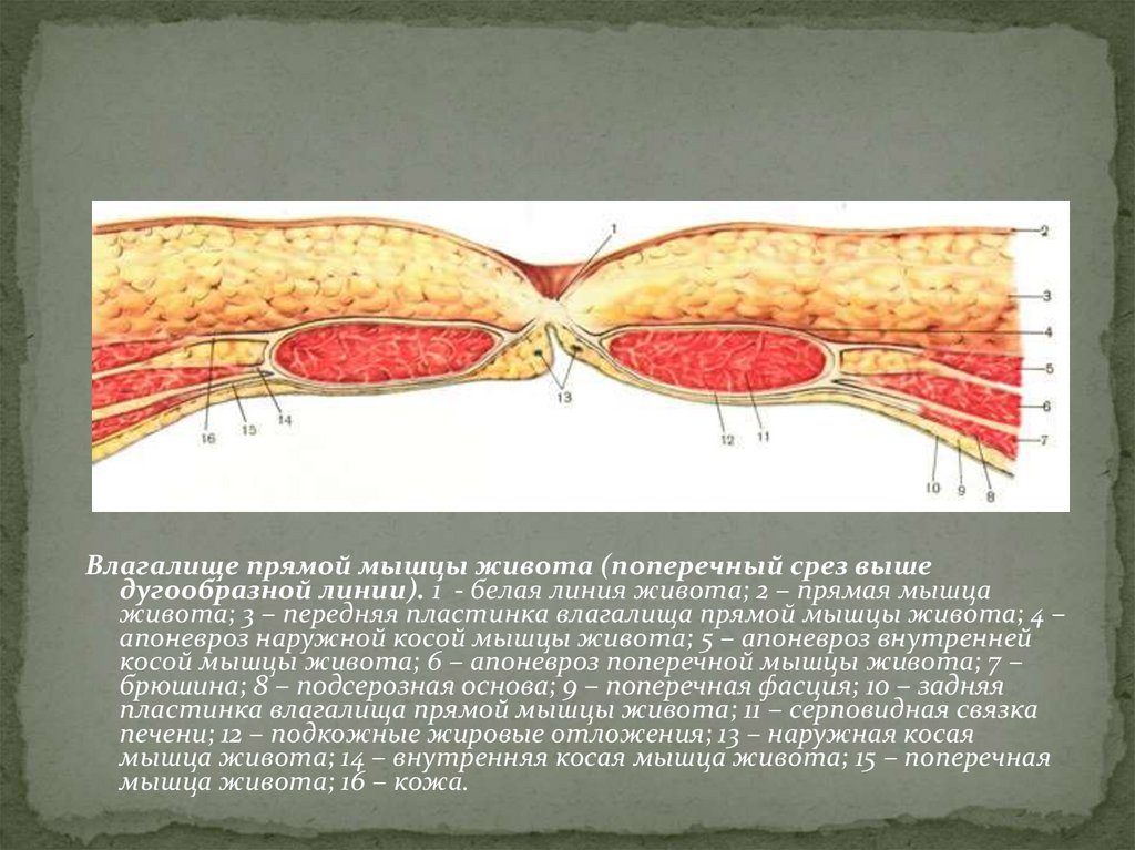 Дугообразная линия живота