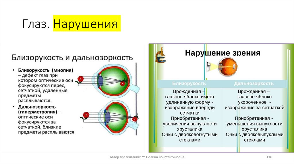 Оптические системы глаза и их нарушения проект по биологии 8 класс