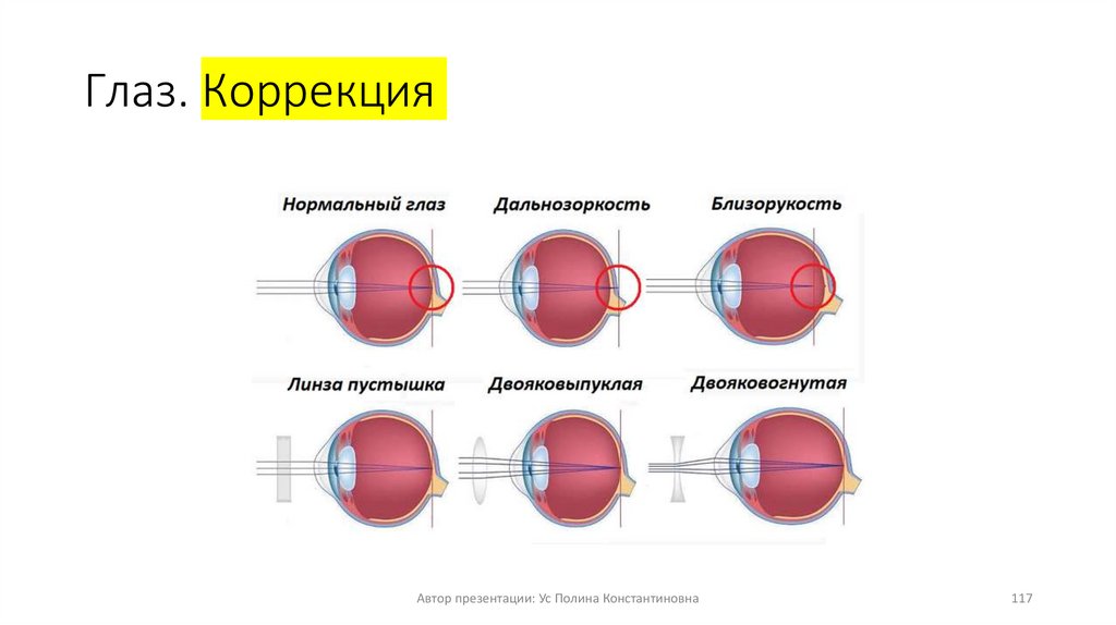Глаз. Коррекция