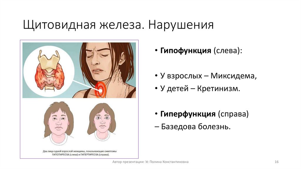 Щитовидная железа. Нарушения