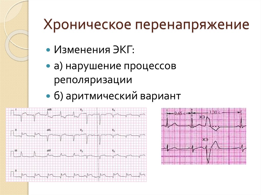 Перенапряжение сердечно сосудистой системы