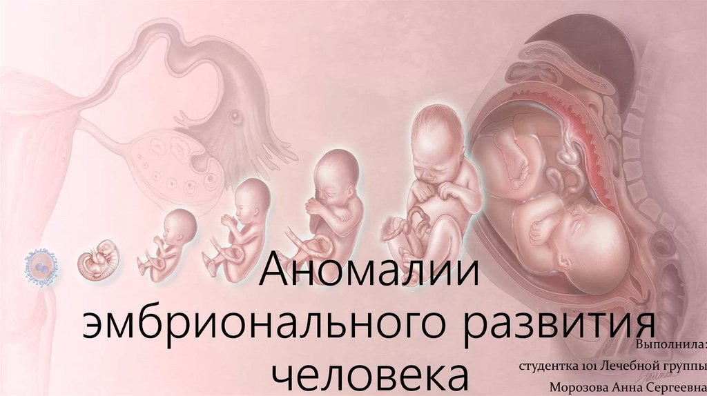 Аномалии эмбрионального развития человека - презентация онлайн