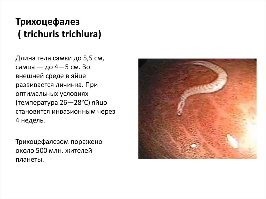 Трихоцефалез ( trichuris trichiura)