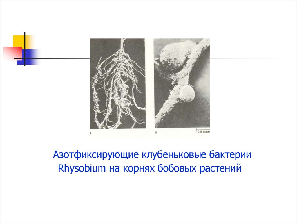 Азотфиксирующие бактерии. Клубеньковые азотфиксирующие. Азотфиксирующие бактерии, холерные. Клубеньковые азотфиксирующие бактерии. Азотфиксирующие бактерии на корнях бобовых.