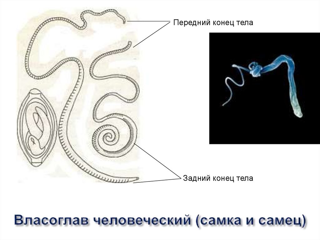 Передний и задний конец червя. Власоглав человеческий самец. Власоглав круглые черви. Власоглав человеческий самка.