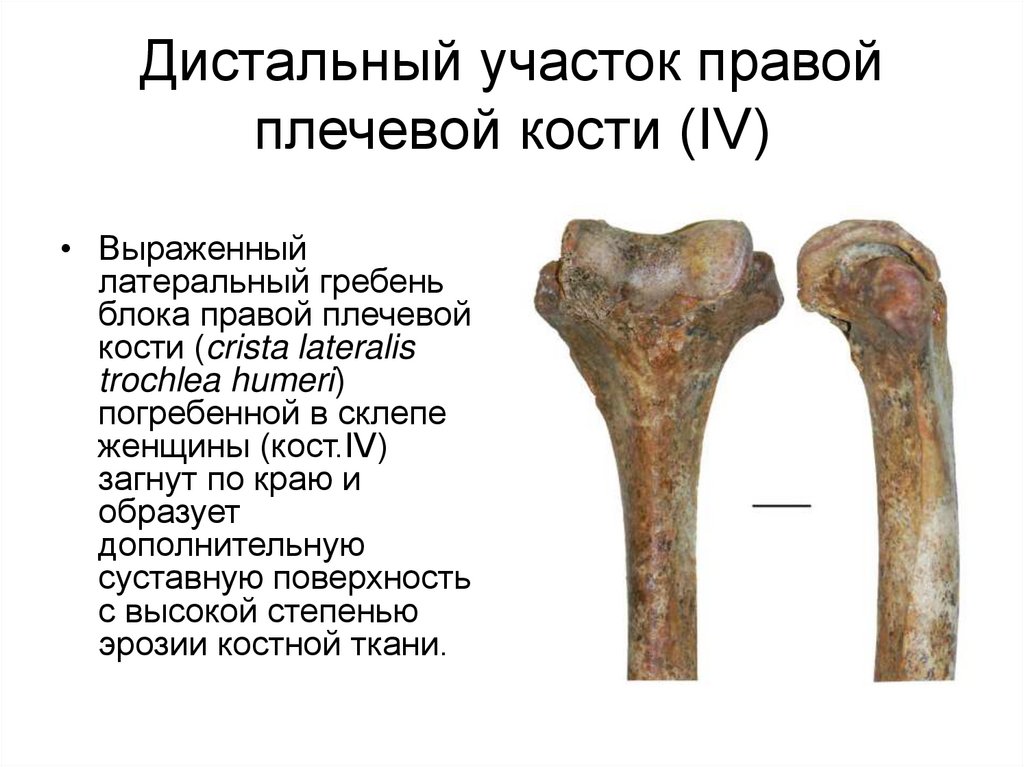 Гребне плечевой кости. Дистальный конец плечевой кости. Проксимальный конец плечевой кости. Дистальная головка плечевой кости. На дистальном конце плечевой кости находятся.