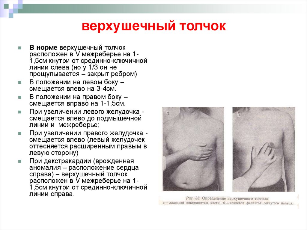 Верхушечный толчок. Пальпация верхушечного толчка. Локализация верхушечного толчка у детей. Верхушечный толчок расположен.