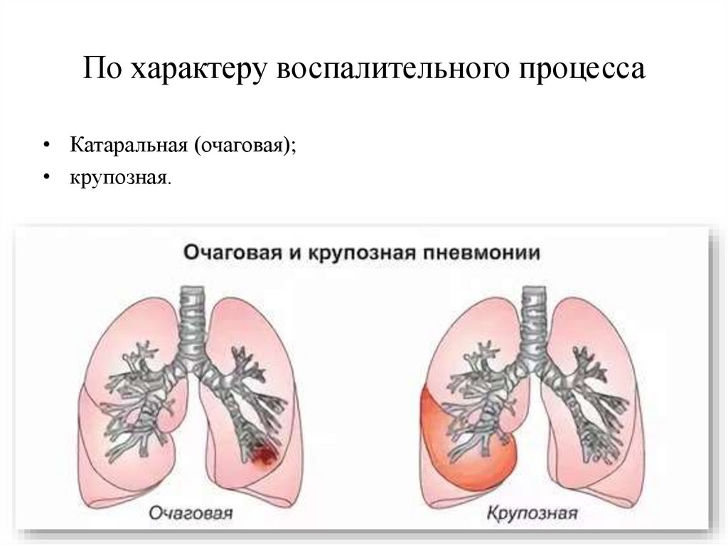 По характеру воспалительного процесса