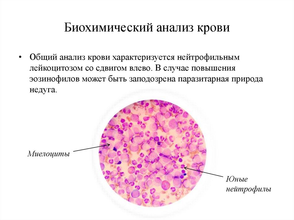 Биохимический анализ крови