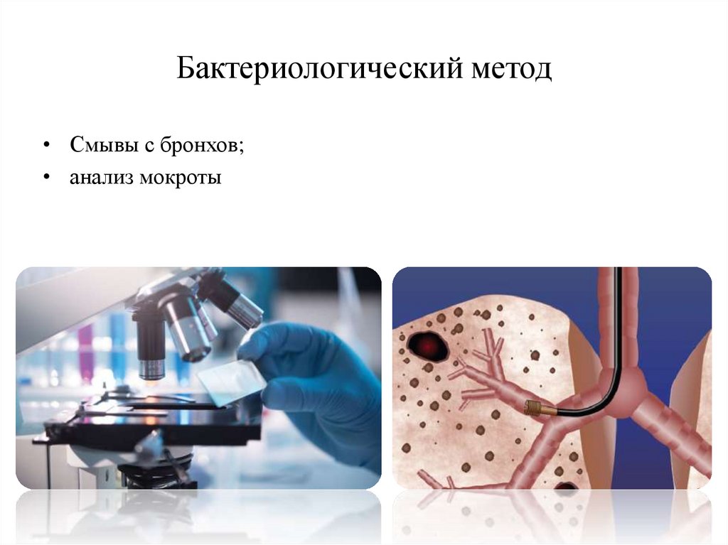 Бактериологический метод