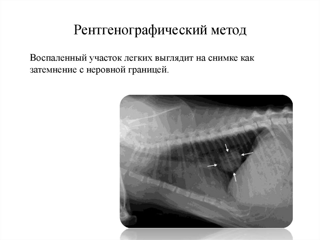Рентгенографический метод
