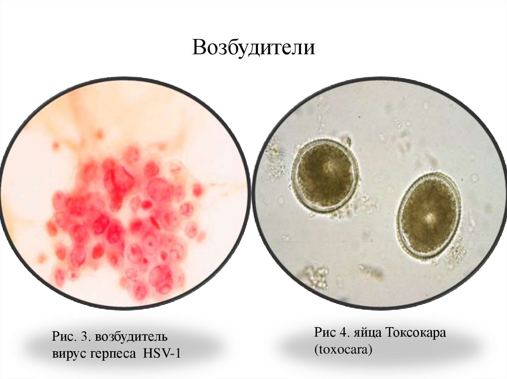 Возбудители