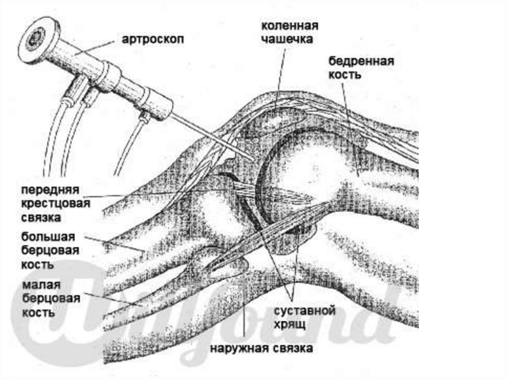 Лопатка топографическая анатомия