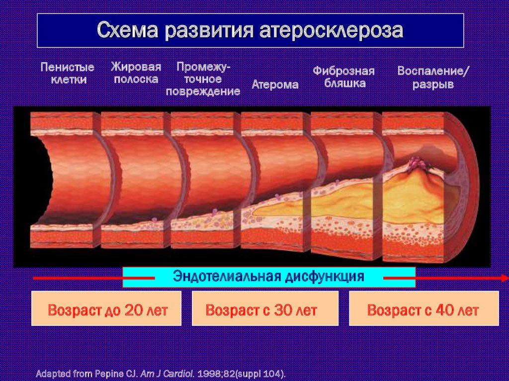 Осложнения атеросклероза тест