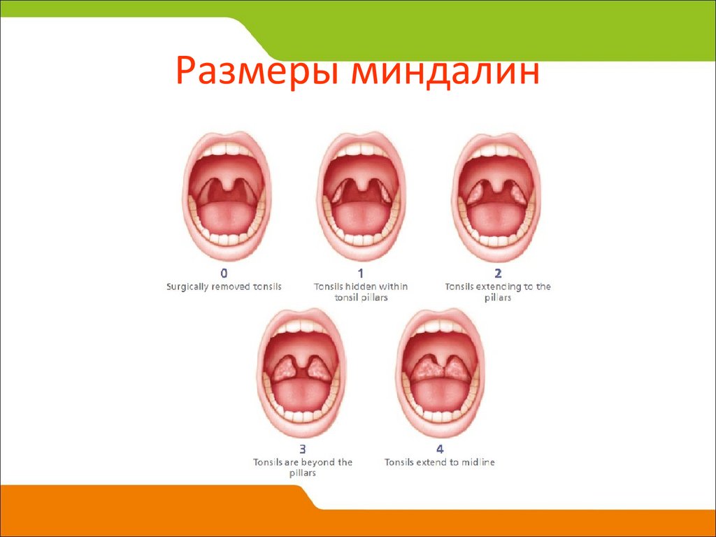 Гланды строение схема