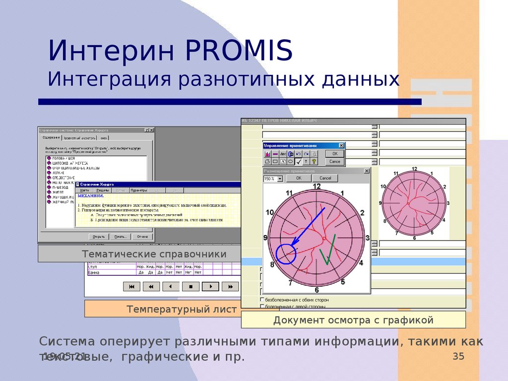 Мис интерин promis презентация