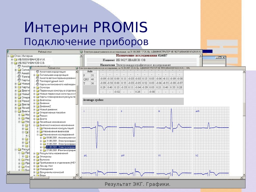 Мис интерин promis презентация