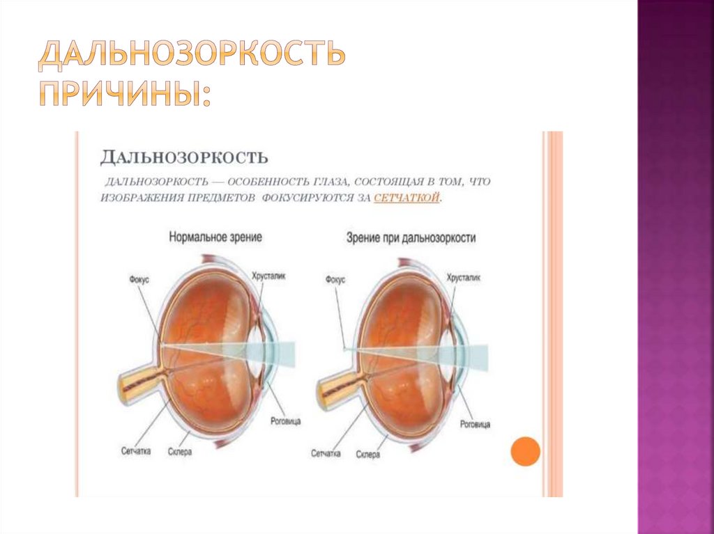 Сигналы глаз презентация