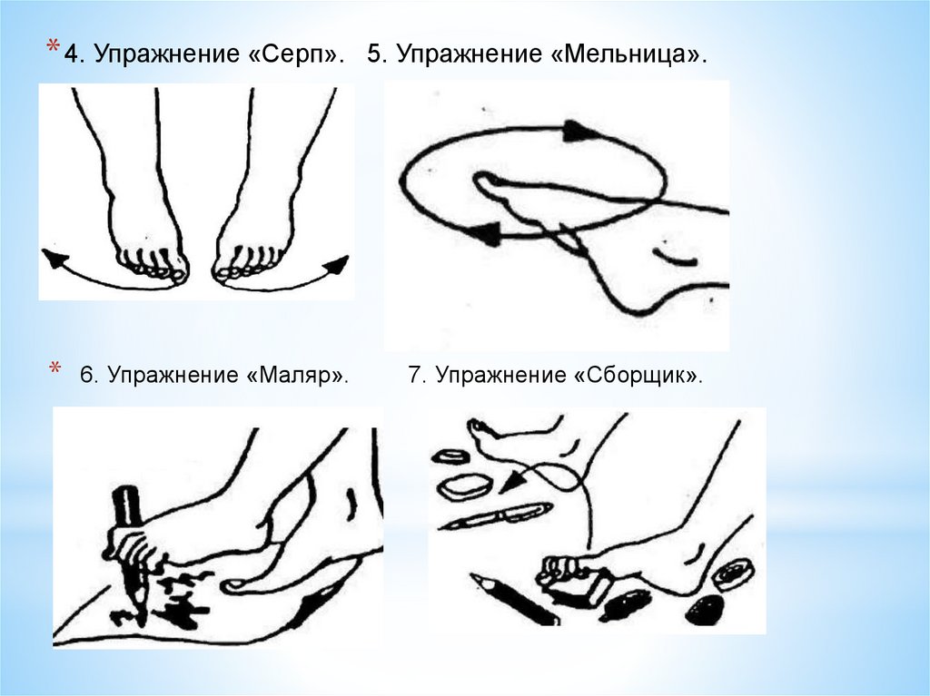 Плоскостопие лфк презентация