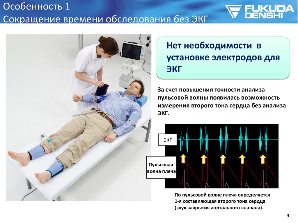 Без обследования. Объемная сфигмография. Сфигмография аппарат. Аппарат для объемной сфигмографии. Сфигмография наложение.