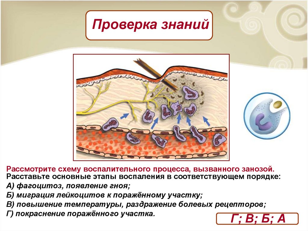 Схема воспалительного процесса