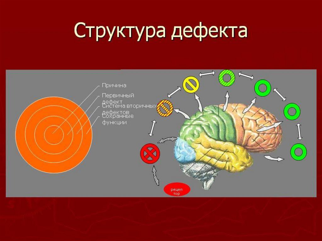 Нарушение структуры. Сложная структура дефекта Выготский понятие. Первичный и вторичный дефект. Дефект структура дефекта. Первичевц и Вторичнвй жеыект.