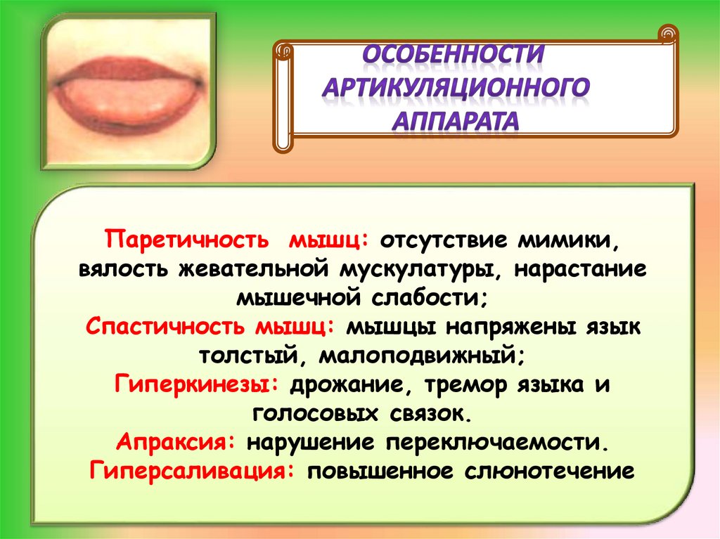 Дизартрия - презентация онлайн