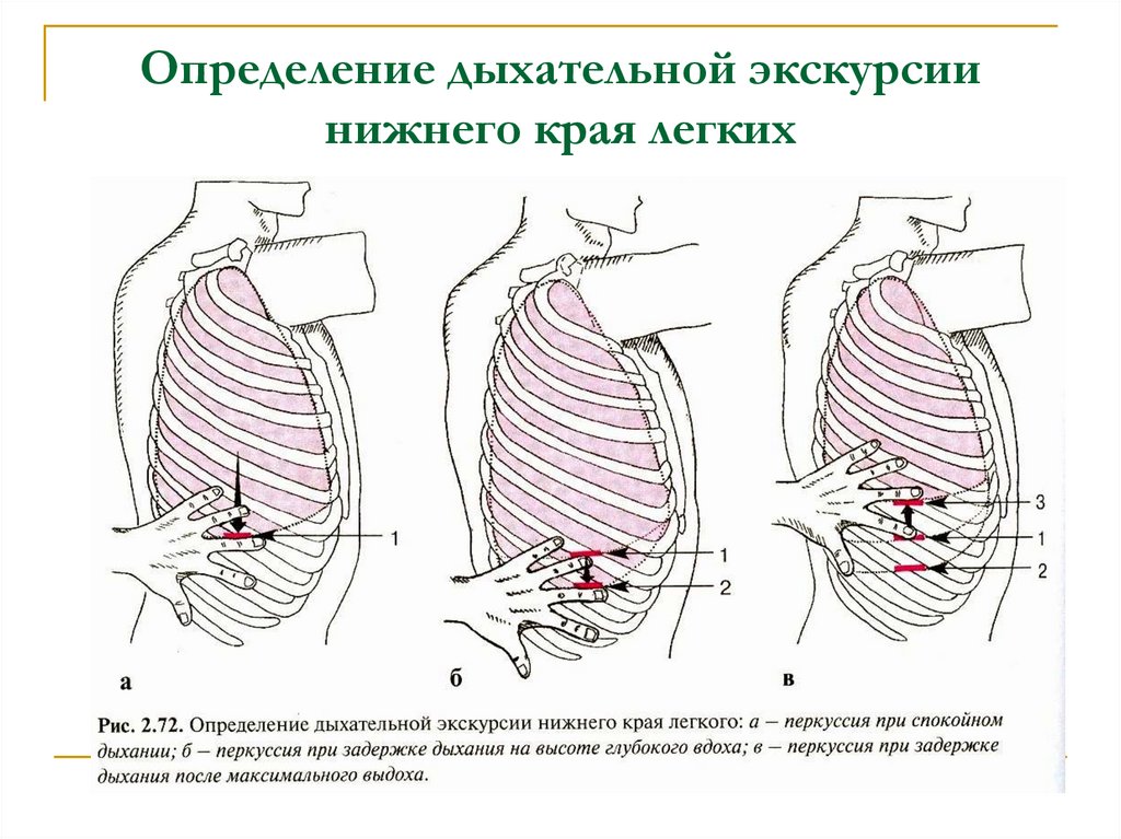 Нижний определить. Перкуссия подвижности Нижнего легочного края. Экскурсия Нижнего края легких перкуссия. Дыхательная подвижность Нижнего легочного края. Определение экскурсии Нижнего края легких.