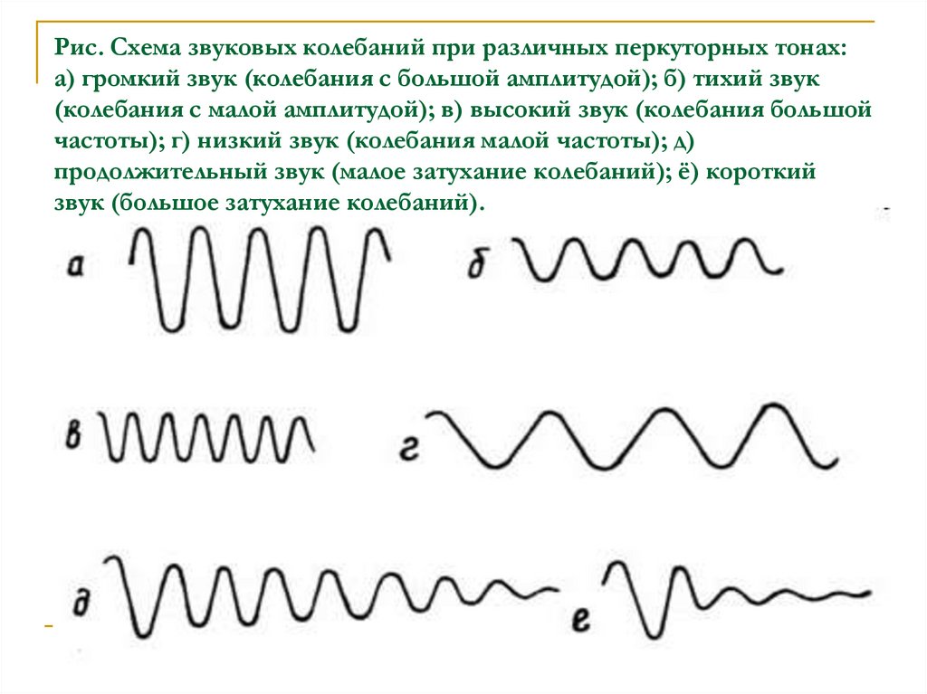 Какого частота звука колебания. Колебания звука. Схема колебаний звука. Колебания звука изображение. График звуковых колебаний.