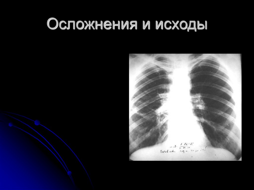 Осложнения и исходы