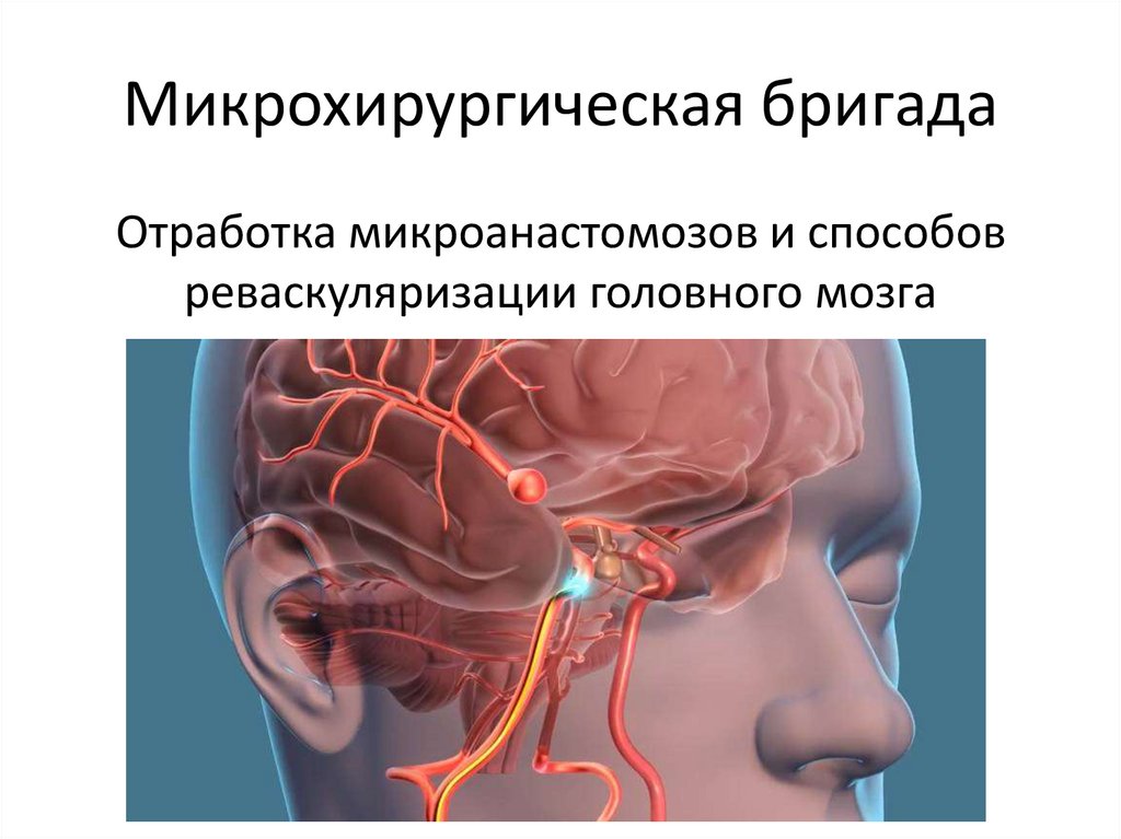 Микрохирургическая бригада