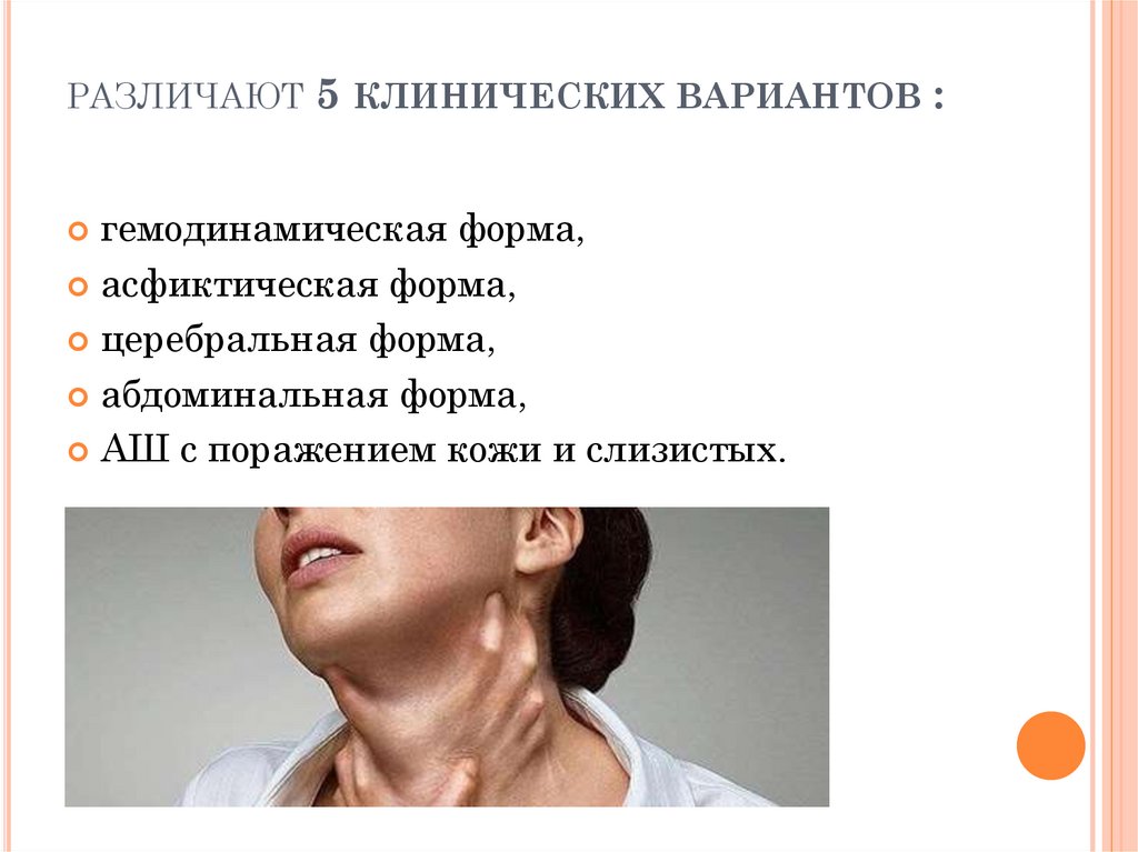 различают 5 клинических вариантов :